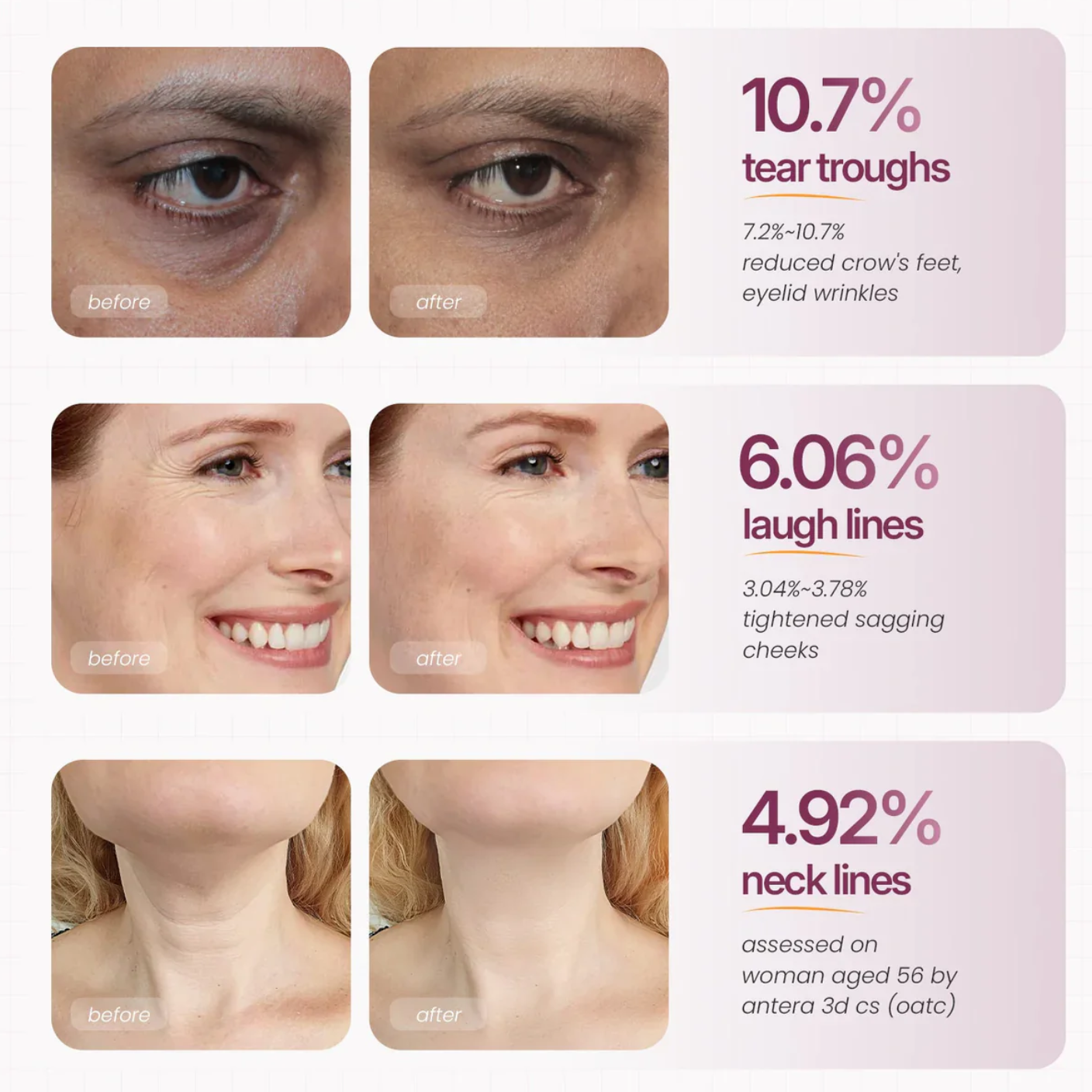 🏆 #1 Bestselling🏆--Cemenrete Calcium Multi Balm 💫 Anti-Aging & Firming Korean Skincare Stick
