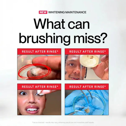 Hismile iD Stain Whitening Mouthwash – Daily Whitening Maintenance & Fresh Breath (237 mL)