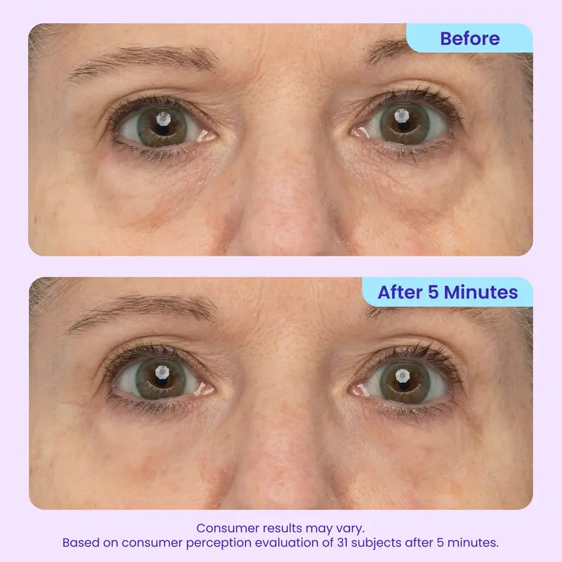 GOPURE Instant Lift Eye Gel – 3-in-1 Under-Eye Depuffing & Smoothing Gel (10 mL)