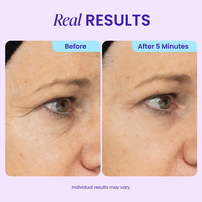 GOPURE Instant Lift Eye Gel – 3-in-1 Under-Eye Depuffing & Smoothing Gel (10 mL)