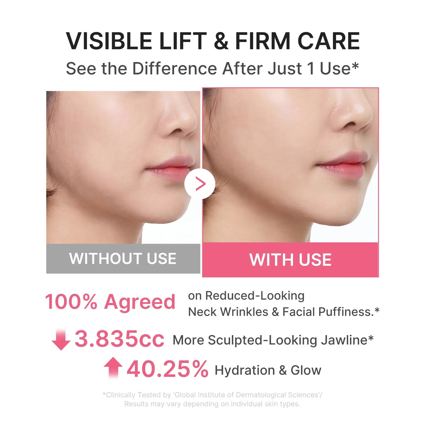PDRN Collagen Gua Sha Neck Cream – 5% Volufiline Firming Massage Cream