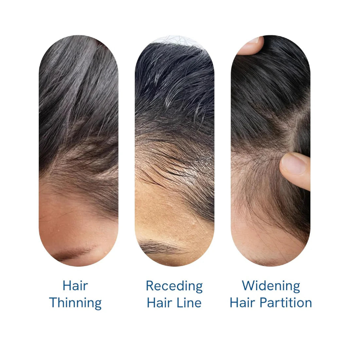 Be Bodywise Advanced Hair Growth Roll-On Serum-HZ