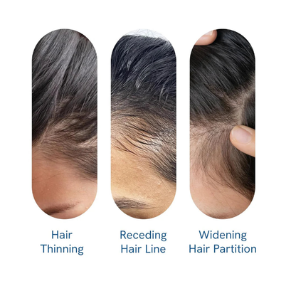 Be Bodywise Advanced Hair Growth Roll-On Serum-HZ