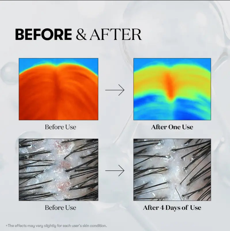 Hair Growth Hair loss treatment ampoule serum-hz