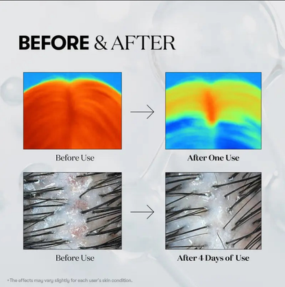 Hair Growth Hair loss treatment ampoule serum-hz